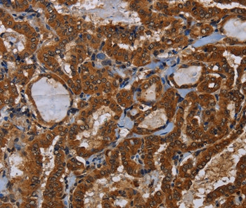 LRRC57 Antibody in Immunohistochemistry (Paraffin) (IHC (P))