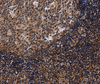 NTMT1 Antibody in Immunohistochemistry (Paraffin) (IHC (P))