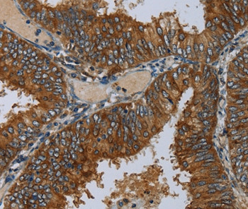 MIER2 Antibody in Immunohistochemistry (Paraffin) (IHC (P))