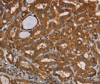 CENPU Antibody in Immunohistochemistry (Paraffin) (IHC (P))