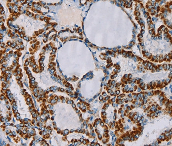 CMC4 Antibody in Immunohistochemistry (Paraffin) (IHC (P))