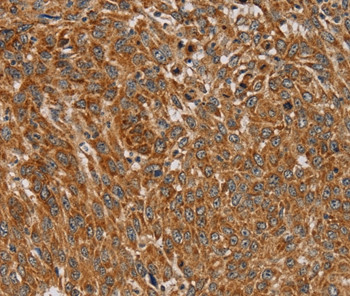 PLEKHG6 Antibody in Immunohistochemistry (Paraffin) (IHC (P))