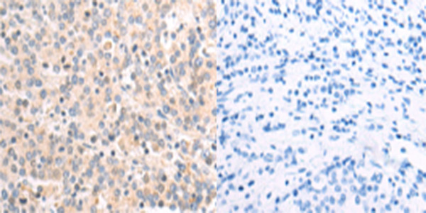 NDUFA1 Antibody in Immunohistochemistry (Paraffin) (IHC (P))