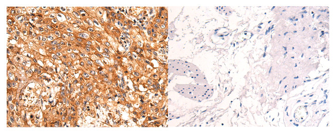 NDUFA2 Antibody in Immunohistochemistry (Paraffin) (IHC (P))