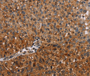 NMT2 Antibody in Immunohistochemistry (Paraffin) (IHC (P))