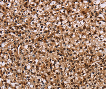 HMGN5 Antibody in Immunohistochemistry (Paraffin) (IHC (P))