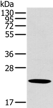 OTUB2 Antibody in Western Blot (WB)