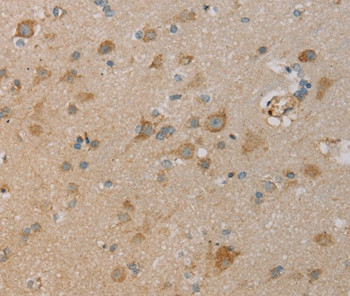 PAGE2 Antibody in Immunohistochemistry (Paraffin) (IHC (P))