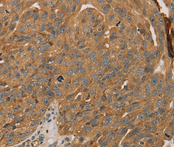 PARP11 Antibody in Immunohistochemistry (Paraffin) (IHC (P))
