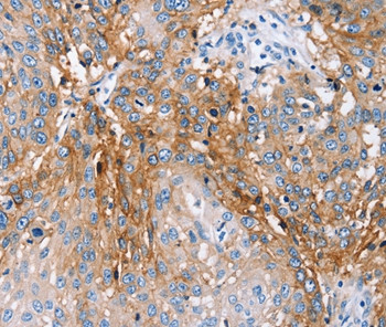 PLCZ1 Antibody in Immunohistochemistry (Paraffin) (IHC (P))