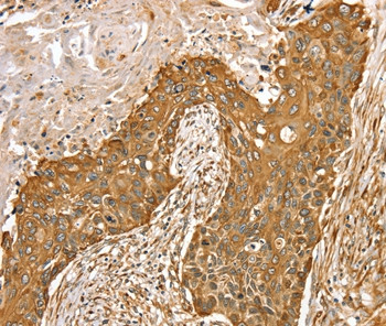 RASSF9 Antibody in Immunohistochemistry (Paraffin) (IHC (P))