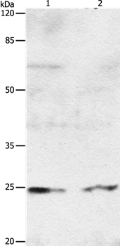 RAB8A Antibody in Western Blot (WB)