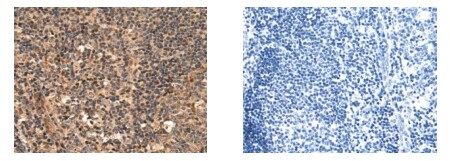 CHRM4 Antibody in Immunohistochemistry (Paraffin) (IHC (P))
