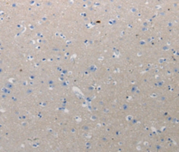 CMTM1 Antibody in Immunohistochemistry (Paraffin) (IHC (P))