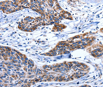 Aquaporin 8 Antibody in Immunohistochemistry (Paraffin) (IHC (P))