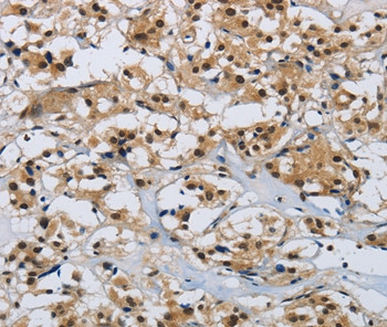 CMTM8 Antibody in Immunohistochemistry (Paraffin) (IHC (P))