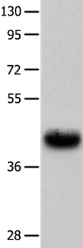 Urotensin II Receptor Antibody in Western Blot (WB)