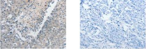 GCH1 Antibody in Immunohistochemistry (Paraffin) (IHC (P))
