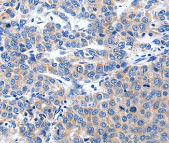 KCNH8 Antibody in Immunohistochemistry (Paraffin) (IHC (P))