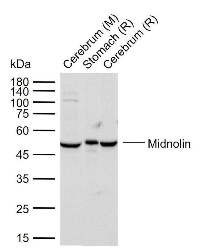 MIDN Antibody in Western Blot (WB)