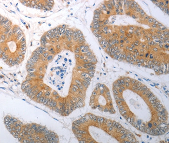 RBMS3 Antibody in Immunohistochemistry (Paraffin) (IHC (P))