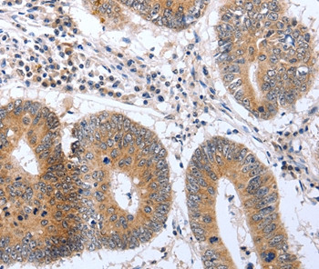PSPN Antibody in Immunohistochemistry (Paraffin) (IHC (P))