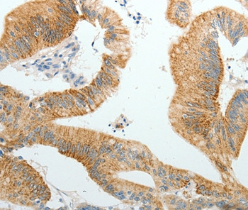PGBD5 Antibody in Immunohistochemistry (Paraffin) (IHC (P))