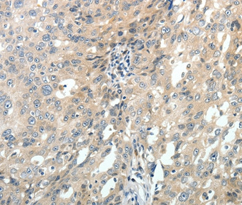 MRP7 Antibody in Immunohistochemistry (Paraffin) (IHC (P))