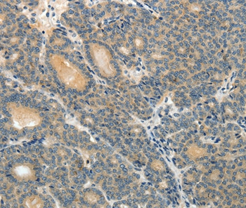 MRP9 Antibody in Immunohistochemistry (Paraffin) (IHC (P))