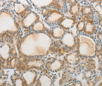 AKAP1 Antibody in Immunohistochemistry (Paraffin) (IHC (P))
