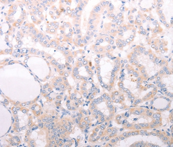 ANKRA2 Antibody in Immunohistochemistry (Paraffin) (IHC (P))