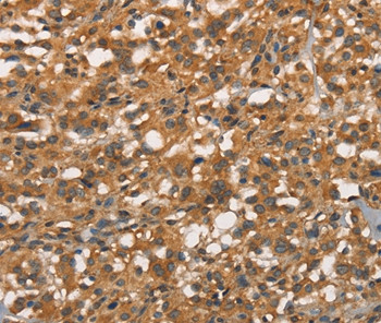 APOC4 Antibody in Immunohistochemistry (Paraffin) (IHC (P))