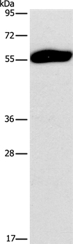 SPAG6 Antibody in Western Blot (WB)