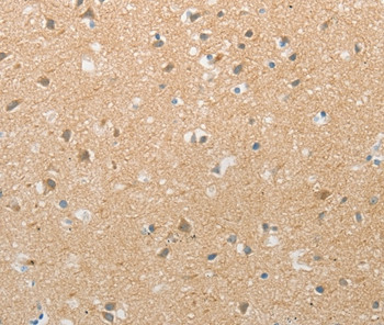 TACR2 Antibody in Immunohistochemistry (Paraffin) (IHC (P))