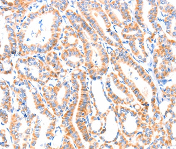 PAFAH2 Antibody in Immunohistochemistry (Paraffin) (IHC (P))