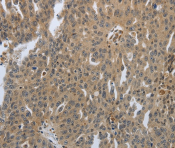 PTPRT Antibody in Immunohistochemistry (Paraffin) (IHC (P))