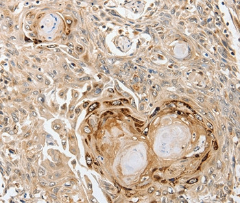 SLC1A7 Antibody in Immunohistochemistry (Paraffin) (IHC (P))