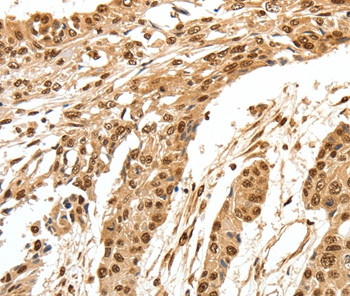 SPATA20 Antibody in Immunohistochemistry (Paraffin) (IHC (P))