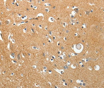 AKAP12 Antibody in Immunohistochemistry (Paraffin) (IHC (P))