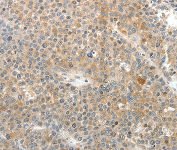 SV2A Antibody in Immunohistochemistry (Paraffin) (IHC (P))