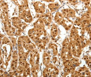 TNN Antibody in Immunohistochemistry (Paraffin) (IHC (P))