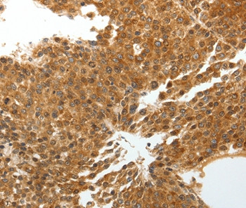 Tenascin X Antibody in Immunohistochemistry (Paraffin) (IHC (P))