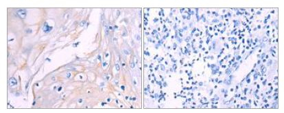 CD93 Antibody in Immunohistochemistry (Paraffin) (IHC (P))
