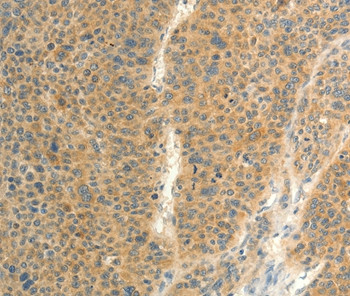 FAT3 Antibody in Immunohistochemistry (Paraffin) (IHC (P))