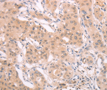 ADAM11 Antibody in Immunohistochemistry (Paraffin) (IHC (P))
