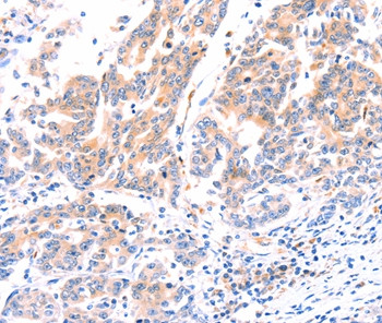 ANKZF1 Antibody in Immunohistochemistry (Paraffin) (IHC (P))
