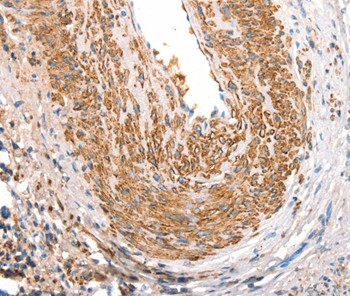 CD297 Antibody in Immunohistochemistry (Paraffin) (IHC (P))