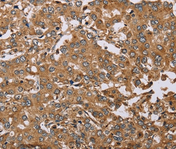 DDAH1 Antibody in Immunohistochemistry (Paraffin) (IHC (P))