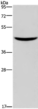 GIPR Antibody in Western Blot (WB)