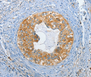 DGKZ Antibody in Immunohistochemistry (Paraffin) (IHC (P))